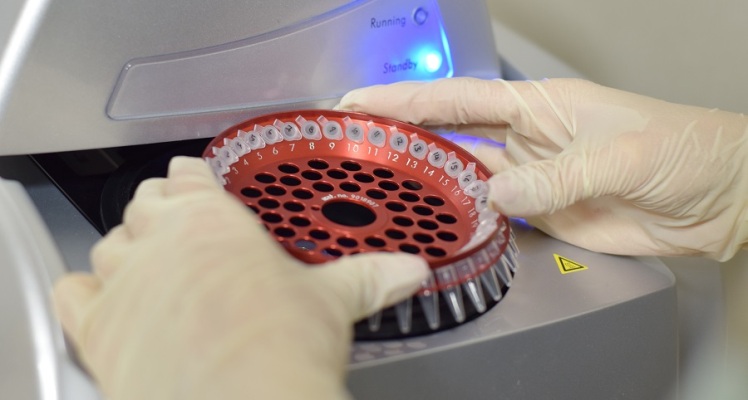 انواع کنترلها در PCR